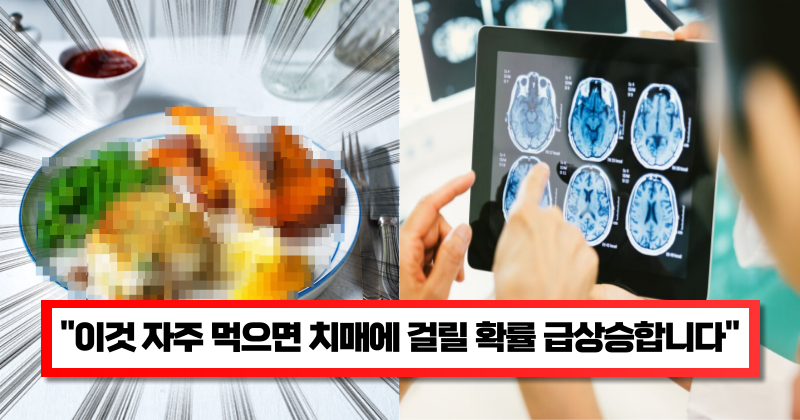 “이런 음식 절대 먹지 마세요” 전문의가 알려주는 뇌졸중과 치매에 걸릴 확률 높여주는 음식 5가지