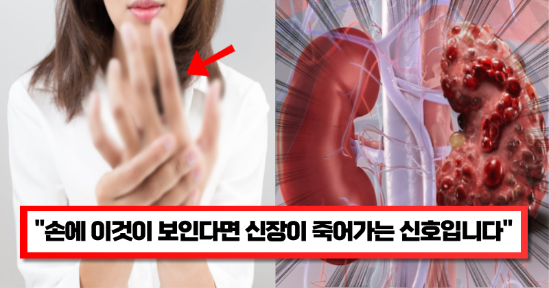 “지금 당장 확인해 보세요” 손의 증상으로 알아보는 우리 몸의 건강 이상 증상 9가지