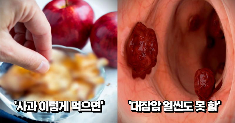 “많이 만들어 매일 드세요” 사과 먹는 방법만 바꿔도 콜레스테롤은 낮춰주고 대장암은 예방해 준다는 사과 레시피