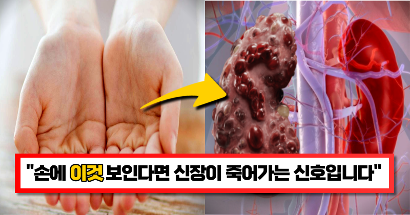 “지금 당장 확인해 보세요” 손에 나타나는 증상에 따라 알 수 있는 우리 몸의 건강 신호 9가지