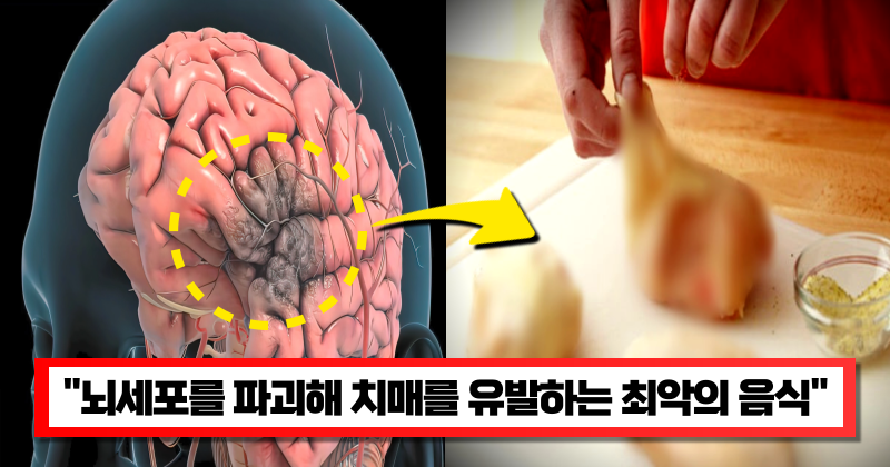 “맛있어도 너무 자주 먹지 마세요” 먹을 때마다 뇌세포를 파괴해 치매에 걸릴 수 있습니다.