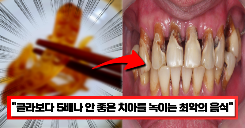 “이것 먹고 있다면 당장 뱉으세요” 치아에 아주 치명적인 콜라보다 5배나 빨리 치아를 망칩니다.