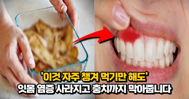 “딱 한 줌만 넣고 끓여보세요” 치아가 누렇게 변하는 것을 방지해 주고 치석과 충치를 막아줍니다.